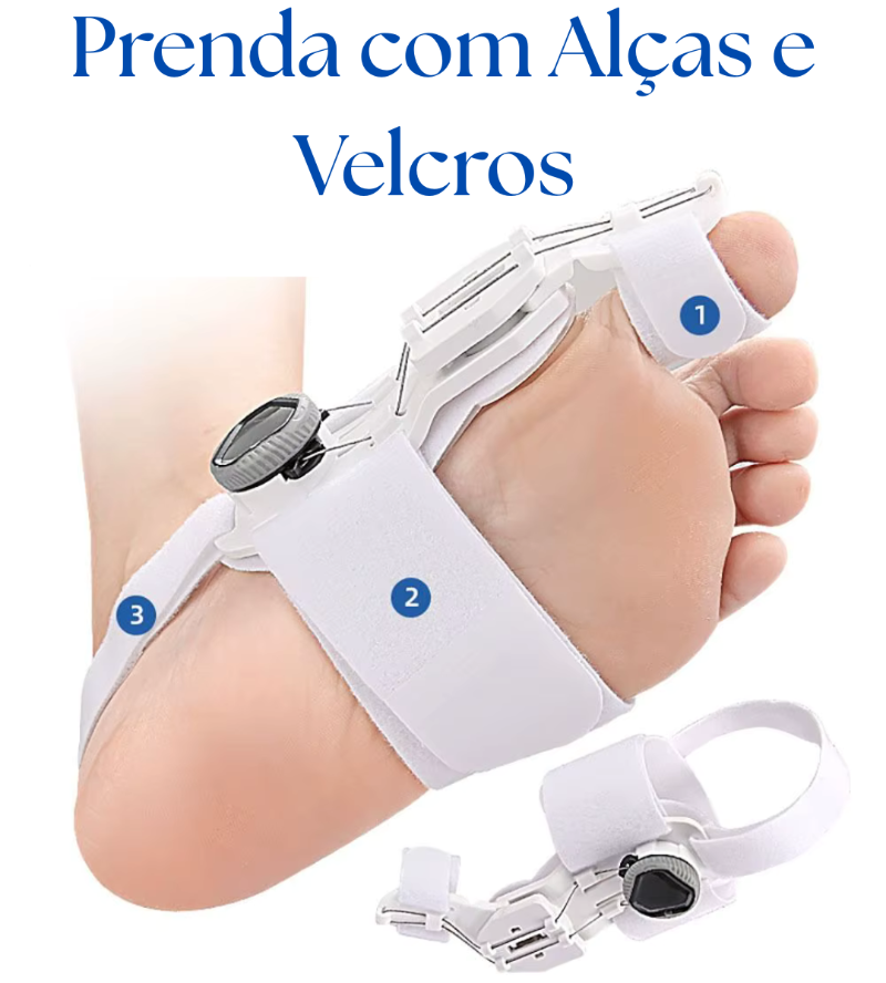 Corretor de Joanete Alinhax – Alívio imediato, correção natural sem cirurgia