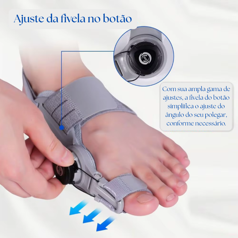 Corretor de Joanete Alinhax – Alívio imediato, correção natural sem cirurgia