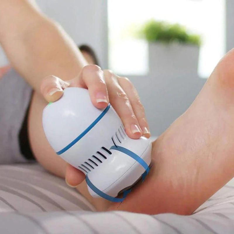 Removedor de calos elétrico CaloClean Pro - Remove calos  e esfolia os pés  sem esforço.